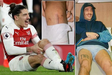 Hector Bellerin Explains Why His Testicles Were On View In Injury