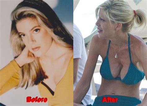 Tori Spelling Plastic Surgery Before After Cumception
