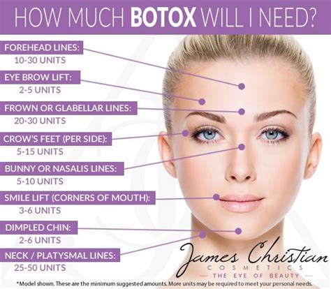 This Handy Infographic Shows How Much Botox You Might Need For Various