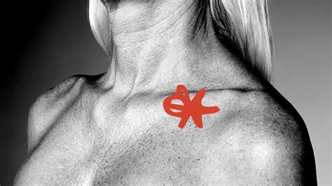 Swollen Supraclavicular Lymph Nodes Causes