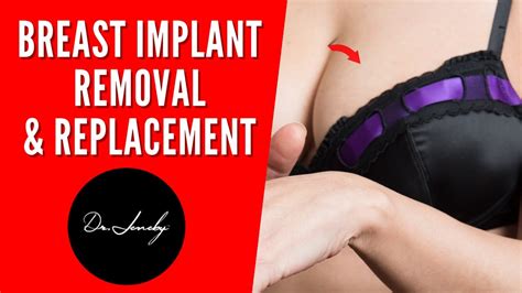 Breast Implant Removal And Replacement In San Antonio With Top Surgeon