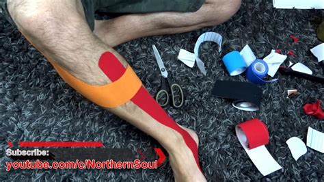 Shin Splints Kinesio Taping Posterior Compartment Syndrome Northern