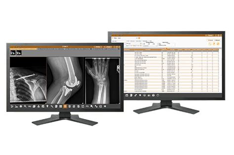 Pacs And Diagnostic Imaging Workstation Paxeraview Paxerahealth