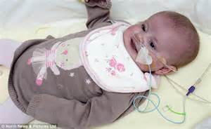 Youngest Ever Baby To Undergo Open Heart Surgery Goes Home For The