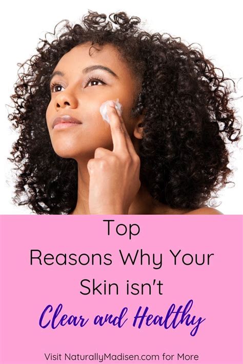 Top Reasons Why Your Skin Isnt Clear And Healthy Naturally Madisen