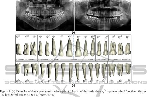 [pdf] Automatic Tooth Identification In Dental Panoramic Images With Atlas Based Models