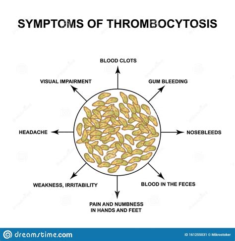 Symptômes De Thrombocytose Augmentation Des Plaquettes Dans Le Sang