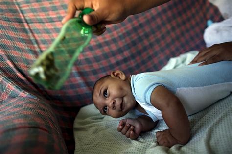 Zika Outbreak In Brazil Doctors Study Mothers And Babies For Proof