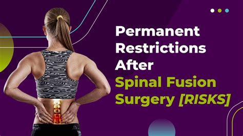 Permanent Restrictions After Spinal Fusion Surgery Risks Youtube