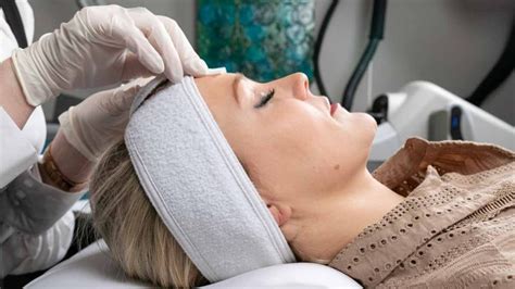 Chemical Peel For Acne Scars Procedure And Benefits 7dmc Dubai