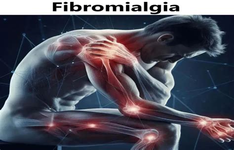 Fibromialgia Fibromyalgia Syndrome Fms Objawy Leczenie