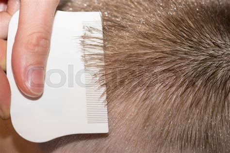 Searching For Lice On A Childs Head Stock Image Colourbox