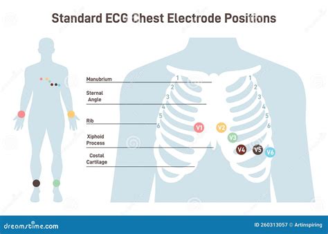 Position Of Ecg Chest Leads Cardiovascular Checkup With Cardiogram