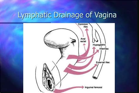 Ppt Vaginal Cancer Powerpoint Presentation Id