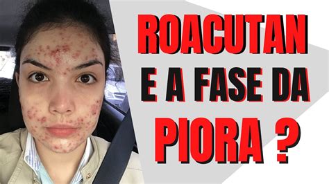 DEVASTADOR FASE DA PIORA DO ROACUTAN EXISTE MESMO Atualizado YouTube