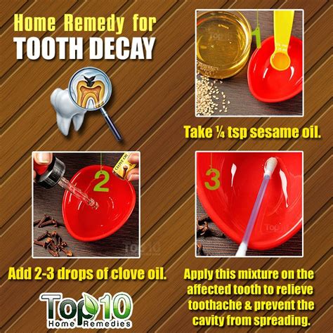 10 items in this article 3 items on sale! Home Remedies for Tooth Decay and Cavities | Top 10 Home ...
