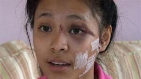 Ky Teen Has Face Slashed In Mall Attack Suspects Sought By Police
