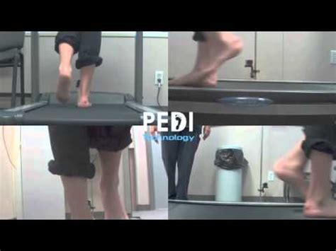 Video Gait Analysis Foot Function Orthotics Heel Pain Mississauga