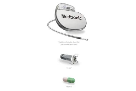 Meeting The Unique Design Requirements For Leadless Pacemaker