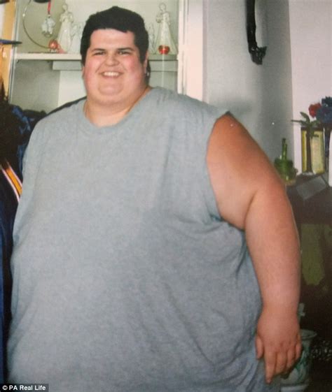 Florida Man Who Weighed 714lbs Shows Reality Of Extreme Weight Loss