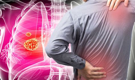 There is no lymph node involvement (n0) and no metastasis (m0). Lung cancer symptoms: This feeling in your chest could be ...
