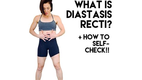 What Is Diastasis Recti And How To Properly Check For It Get Mom Strong