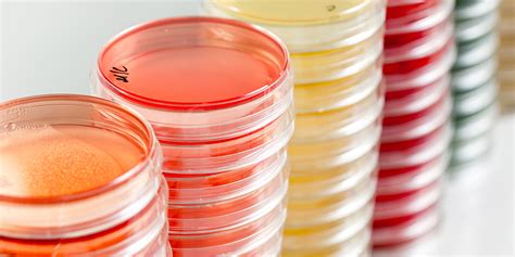 9 Tips For Growth Promotion Testing On Selective Media Microbiologics