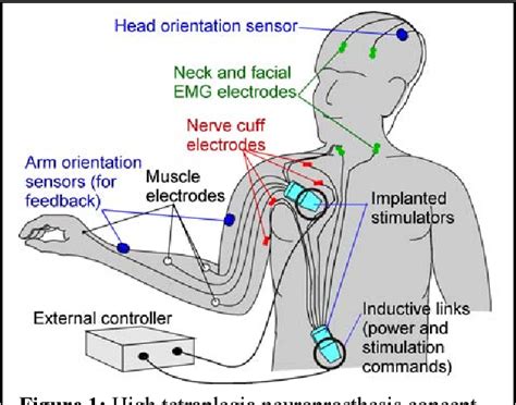 Figure 1 From Development Of A Neuroprosthesis For Restoring Arm And