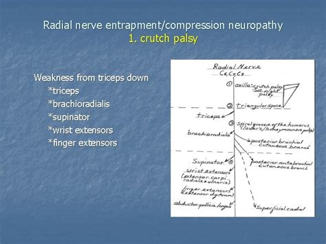Common Sites Of Peripheral Nerve Entrapmentcompression Common Peripheral
