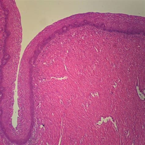 Human Stratified Squamous Epithelium Sec 7 µm Hande