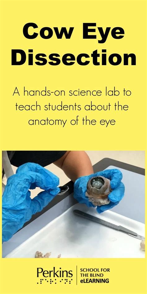 ️cow Eye Dissection Lab Worksheet Free Download