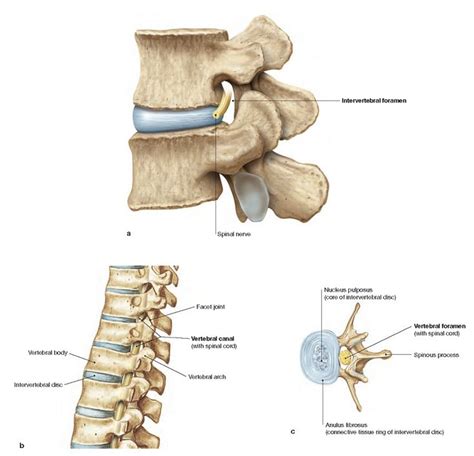 Vertebrae Foramina Anatomy Spinal Stenosis Vertebrae