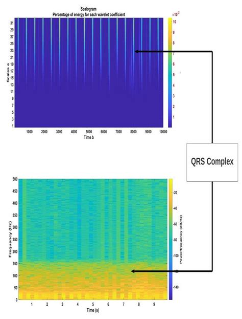 Spectrogram Vs Scalogram Download Scientific Diagram