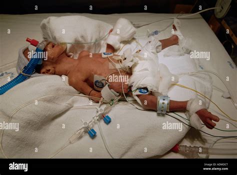 Premature Baby At Neonatal Intensive Care Unit Stock Photo Alamy
