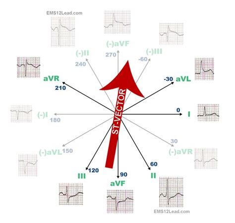 Ecg Vector At Collection Of Ecg Vector Free For Personal Use