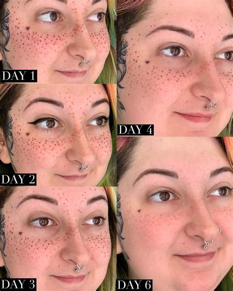 Semi Permanent Freckle Tattoos The Ultimate Guide