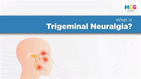 Trigeminal Neuralgia Dr Parh Jani Neurosurgeon Expert Care Hcg Hospitals Healthcare