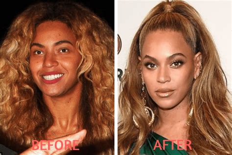 Celebrity Before And After Plastic Surgery Shocks Unifresher