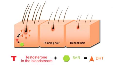Prp For Hair Loss And Thinning Juverne