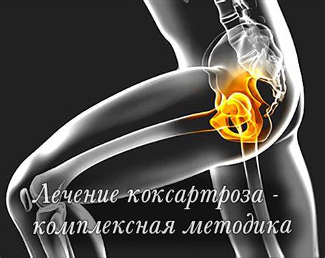 Коксартроз тазобедренного сустава диета питание Как одолеть коксартроз тазобедренного сустава — комплексный метод Как одолеть коксартроз тазобедренного сустава — комплексный метод Коксартроз тазобедренного сустава диета питание