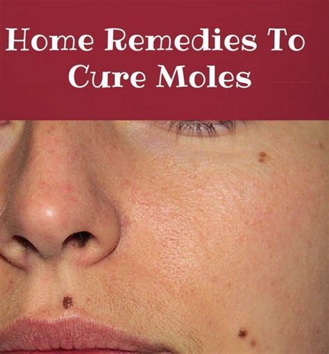 How To Care For Mole Removal Carc