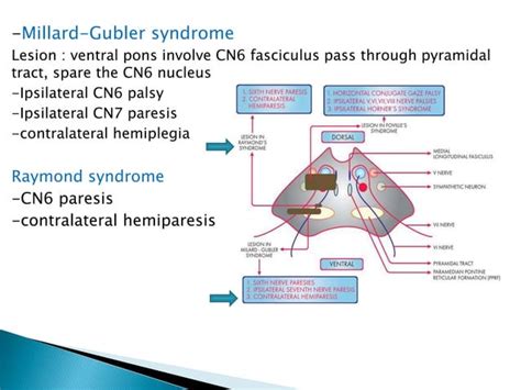 Multiple Cranial Nerve Palsy Final Ppt