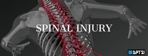 Doctors Physical Therapy And Sports Institute Spinal Injuries