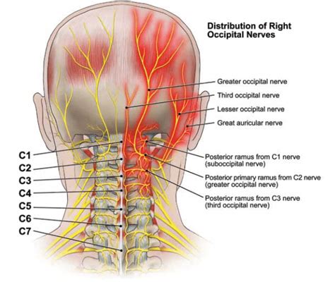 Peripheral Neuralgia Trigeminal Occipital And Ilioinguinal