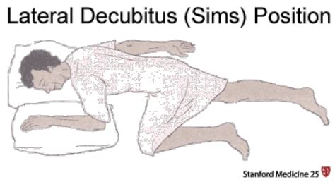 Rectal Exam Stanford Medicine 25 Stanford Medicine