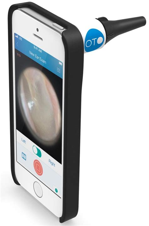 Cellscopes Oto Home Lets Parents Perform Ear Exams With A Smartphone