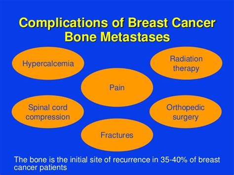 Breast Cancer Current Concepts