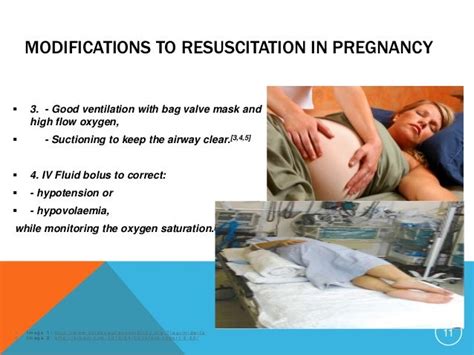 Resuscitation Techniques In Pregnancy
