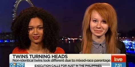 Tv Host Apologizes After Congratulating Light Skin Of Biracial Teen Huffpost