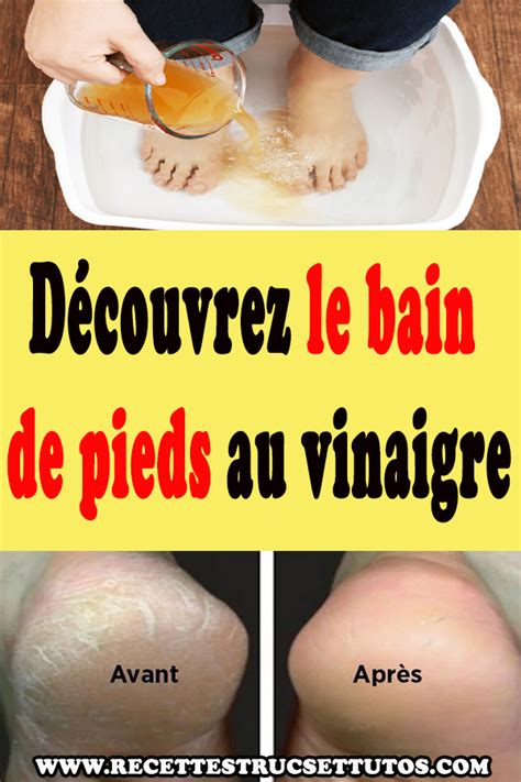 Pin on santé